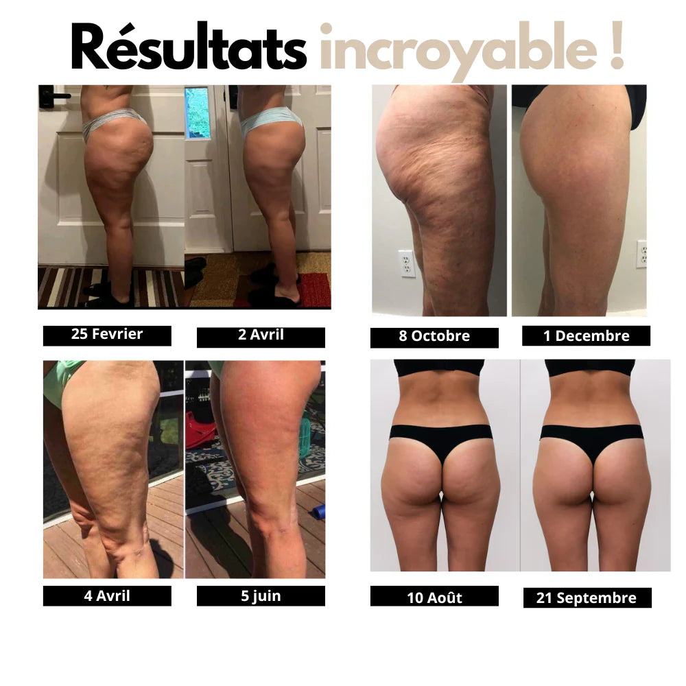 Legging anti cellulite